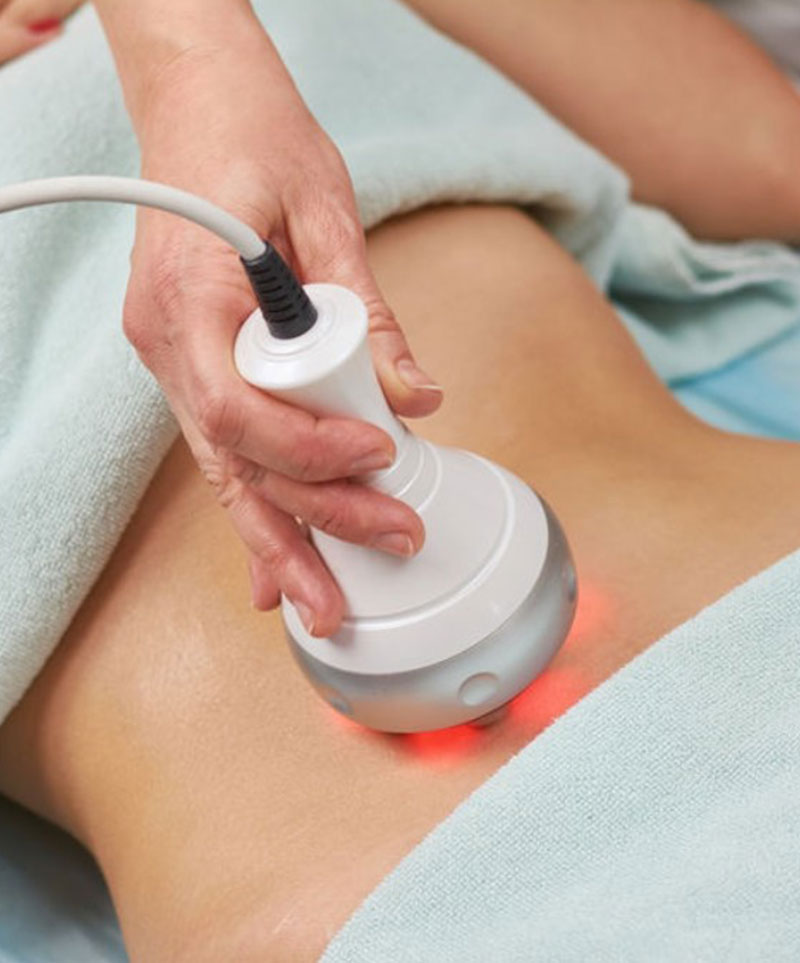 alakformalas-cellulit-kezeles-tatabanya